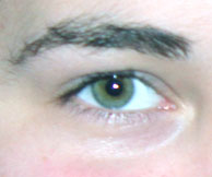 Thumbnail image for Laser Eye Surgery PLR Bundle